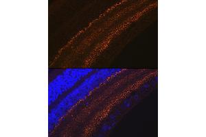 Immunofluorescence analysis of rat retina using G Rabbit mAb (ABIN7267515) at dilution of 1:100 (40x lens). (GAP43 anticorps)