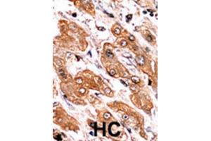 Immunohistochemistry (IHC) image for anti-BCL2-Interacting Killer (Apoptosis-Inducing) (BIK) (pThr33) antibody (ABIN2970932) (BIK anticorps  (pThr33))