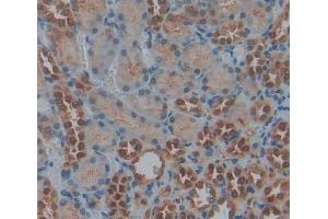 Used in DAB staining on fromalin fixed paraffin- embedded kidney tissue (PRKX anticorps  (AA 49-358))