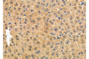 ABIN6264567 and ABIN6276965 at 1/100 staining Mouse liver tissue by IHC-P. (RAB27A anticorps  (C-Term))