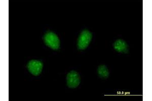 Immunofluorescence of purified MaxPab antibody to PARP3 on HeLa cell.