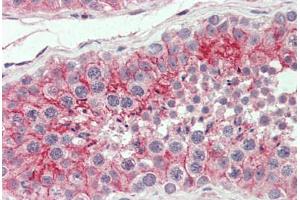 Anti-CXADR antibody  ABIN960759 IHC staining of human testis. (Coxsackie Adenovirus Receptor anticorps  (Internal Region))