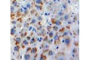 Used in DAB staining on fromalin fixed paraffin-embedded Liver tissue (Melatonin Receptor 1A anticorps  (AA 300-353))