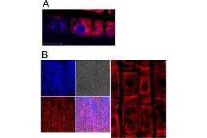Image no. 2 for anti-Heat Shock 70kDa Protein 5 (Glucose-Regulated Protein, 78kDa) (HSPA5) antibody (ABIN349665) (GRP78 anticorps)