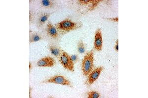 Anti-P cadherin antibody, ICC ICC: A549 Cell