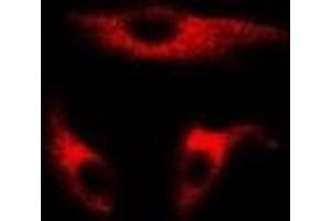 Immunofluorescent analysis of UBE2J2 staining in MCF7 cells.