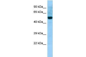 WB Suggested Anti-ABI2 Antibody Titration: 1. (ABI2 anticorps  (N-Term))