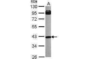WB Image Sample (30 ug of whole cell lysate) A: NT2D1 10% SDS PAGE antibody diluted at 1:1000 (INPP5A anticorps)
