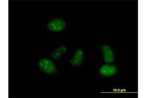 Immunofluorescence of purified MaxPab antibody to ALS2CR15 on HeLa cell. (ICA1L anticorps  (AA 1-482))