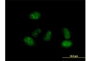 Immunofluorescence of purified MaxPab antibody to ALS2CR15 on HeLa cell. (ICA1L anticorps  (AA 1-482))