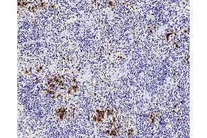Immunohistochemistry analysis of paraffin-embedded Rat inflammatory spleen using ITGAX Polyclonal Antibody at dilution of 1:200.
