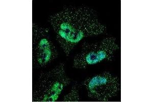 Confocal immunofluorescent analysis of HuR antibody with NCI-H460 cells followed by Alexa Fluor 488-conjugated goat anti-mouse lgG (green).