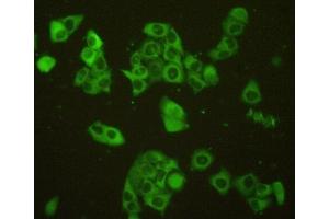 Detection of Sp100 in MCF7 cells using Polyclonal Antibody to Sp100 Nuclear Antigen (Sp100) (SP100 anticorps  (AA 610-802))