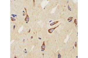 IHC analysis of FFPE human brain using CB2 antibody at 1:25. (CNR2 anticorps  (AA 329-356))