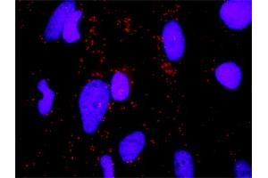Proximity Ligation Analysis of protein-protein interactions between ERBB3 and ERBB2.