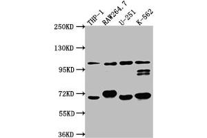 Western Blot Positive WB detected in: THP-1 whole cell lysate, RAW264. (Recombinant TLR5 anticorps)