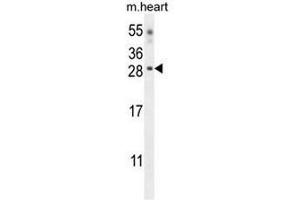 CLDN6 Antibody (Center) western blot analysis in mouse heart tissue lysates (35µg/lane). (Claudin 6 anticorps  (Middle Region))