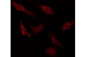 ABIN6276048 staining HuvEc by IF/ICC. (MCHR2 anticorps  (C-Term))
