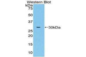 Detection of Recombinant vWA1, Rat using Polyclonal Antibody to Von Willebrand Factor A Domain Containing Protein 1 (vWA1) (VWA1 anticorps  (AA 43-285))