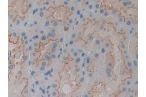 Detection of ACTN4 in Human Kidney Tissue using Polyclonal Antibody to Actinin Alpha 4 (ACTN4)