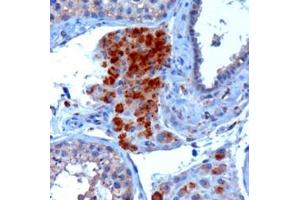 ABIN185714 (3µg/ml) staining of paraffin embedded Human Testis. (SECISBP2 anticorps  (Internal Region))
