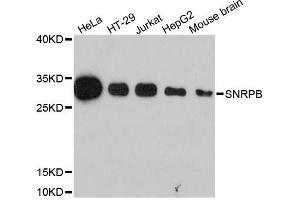 Western blot analysis of extracts of various cell lines, using SNRPB antibody (ABIN5995789) at 1:3000 dilution. (SNRPB anticorps)