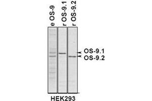 Immunoprecipitation of OS9 in 293 cells expressing OS9. (OS9 anticorps  (AA 300-400))