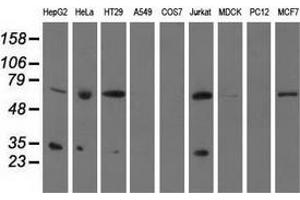 Western blot analysis of extracts (35 µg) from 9 different cell lines by using anti-PYCR2 monoclonal antibody. (PYCR2 anticorps)
