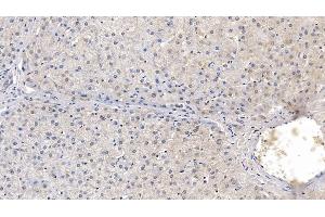 Detection of LCAT in Human Liver Tissue using Monoclonal Antibody to Lecithin Cholesterol Acyltransferase (LCAT)