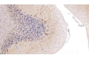 Detection of CALB in Human Cerebellum Tissue using Polyclonal Antibody to Calbindin (CALB) (CALB1 anticorps  (AA 3-261))
