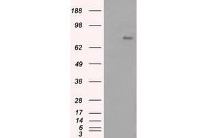 Image no. 7 for anti-Bruton Agammaglobulinemia tyrosine Kinase (BTK) antibody (ABIN1496974) (BTK anticorps)