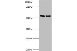Western blot All lanes: TRIM27 antibody at 4 μg/mL Lane 1: Jurkat whole cell lysate Lane 2: HepG2 whole cell lysate Secondary Goat polyclonal to rabbit IgG at 1/10000 dilution Predicted band size: 59, 42 kDa Observed band size: 59 kDa (TRIM27 anticorps  (AA 214-513))