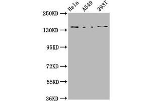 Western Blot Positive WB detected in: Hela whole cell lysate, A549 whole cell lysate, 293T whole cell lysate All lanes: CNGB1 antibody at 4. (GARP anticorps  (AA 131-253))