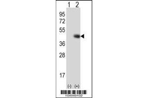 Western blot analysis of TPST1 using rabbit polyclonal TPST1 Antibody (K351) using 293 cell lysates (2 ug/lane) either nontransfected (Lane 1) or transiently transfected (Lane 2) with the TPST1 gene. (TPST1 anticorps  (C-Term))
