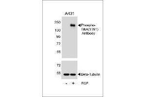 Western blot analysis of lysates from A431 cell line, untreated or treated with EGF, 100 ng/mL, using Phospho-TrkA Antibody (ABIN389679 and ABIN2839650) (upper) or Beta-Tubulin (lower). (TRKA anticorps  (pTyr791))