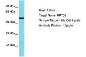 Image no. 1 for anti-Keratin 38 (KRT38) (AA 206-255) antibody (ABIN6750574) (KRT38 anticorps  (AA 206-255))