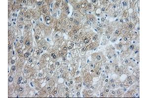 Image no. 10 for anti-Acetyl-CoA Acetyltransferase 2 (ACAT2) antibody (ABIN1496401) (ACAT2 anticorps)