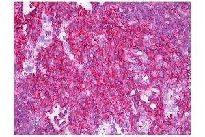 Image no. 1 for anti-Synaptosomal-Associated Protein, 23kDa (SNAP23) antibody (ABIN347010) (SNAP23 anticorps)