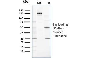 SDS-PAGE Analysis Purified NME2 / nm23-H2 Mouse Monoclonal Antibody (CPTC-NME2-2).