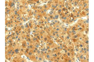 Immunohistochemistry (IHC) image for anti-THAP Domain Containing, Apoptosis Associated Protein 3 (THAP3) antibody (ABIN5961952)