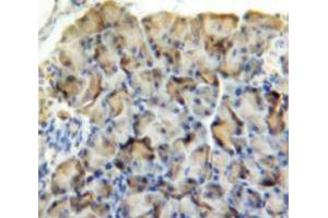 Used in DAB staining on fromalin fixed paraffin-embedded Pancreas tissue