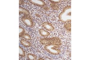 Immunohistochemical analysis of (ABIN657470 and ABIN2846498) on paraffin-embedded Human uterus tissue. (Estrogen Receptor alpha anticorps  (AA 246-273))