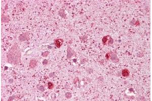 Anti-GSX2 / GSH2 antibody IHC staining of human brain, cortex.