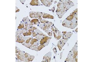 Immunohistochemistry of paraffin-embedded mouse heart using MRPS6 antibody (ABIN6003616) at dilution of 1/100 (40x lens). (MRPS6 anticorps)