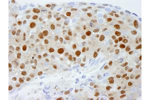 Immunohistochemistry (IHC) image for anti-Damage Specific DNA Binding Protein 1 (DDB1) (C-Term) antibody (ABIN7448511)