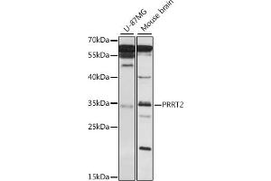 Western blot analysis of extracts of various cell lines, using PRRT2 antibody (ABIN7269559) at 1:1000 dilution.