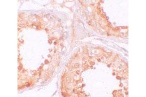 Immunohistochemical staining of human testis cells with YBX2 polyclonal antibody  at 10 ug/mL. (YBX2 anticorps  (C-Term))