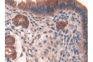 Detection of GR in Mouse Uterus Tissue using Polyclonal Antibody to Glutathione Reductase (GR)