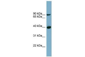 PNPLA8 antibody used at 1 ug/ml to detect target protein. (PNPLA8 anticorps  (Middle Region))