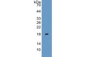 Rabbit Capture antibody from the kit in WB with Positive Control: Sample Human Testis lysate. (IL-17 Kit CLIA)